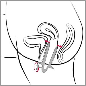 Genital Speculum Argintiu Thumb 5